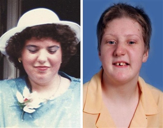 تقتل ابنتها المعاقة وتنتحر.. هروبا من السخرية والمضايقات!!