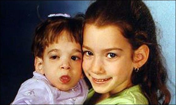 تعد سنوات ولكنها لا تكبر! فتاة 17 عاما بحجم طفل رضيع!! 