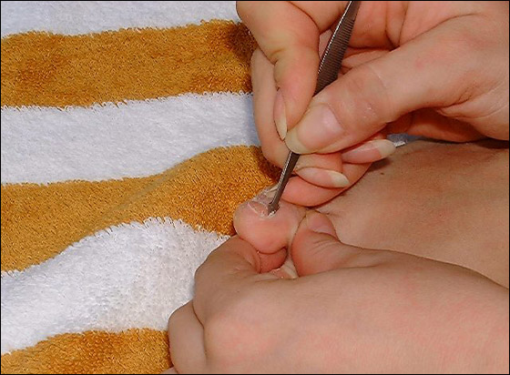 إليك من موقع شايف طريقة البديكير بالصور!!