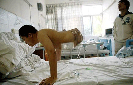 بعد استئصال نصفه افتتح متجر نصف رجل بنصف السعر!