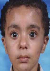 حالة مرضيّة في اليمن.. طفل 3 سنوات يحمل أعضاء جنسية لبالغ!