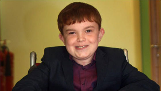 نجاح أول عملية زرع قصبة هوائية لطفل إيرلندي!!