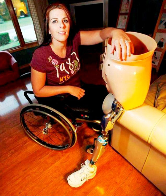 قطعوها إلى نصفين وأعادوا تركيبها من جديد لشفائها من السرطان!