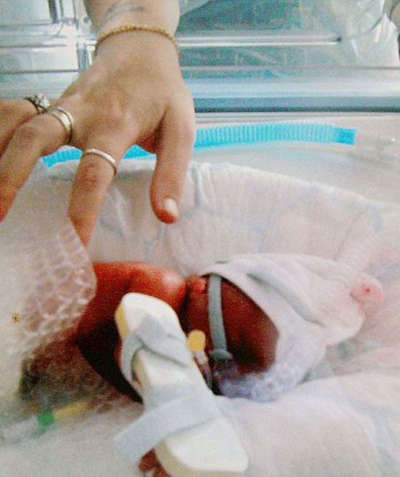 كيس سندويشات في مطبخ المستشفى يبقي المولودة حيّة 