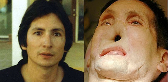 اليك وجها لوجه.. زوجة تتبرع بوجه زوجها لرجل آخر! 