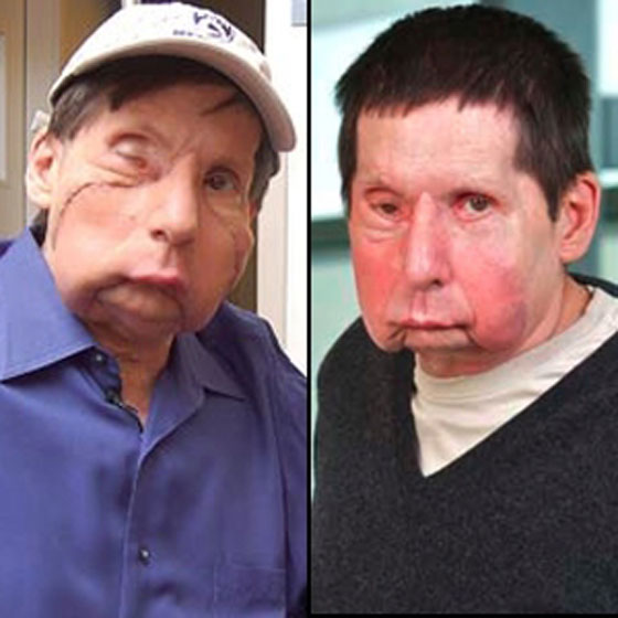 اليك وجها لوجه.. زوجة تتبرع بوجه زوجها لرجل آخر! 