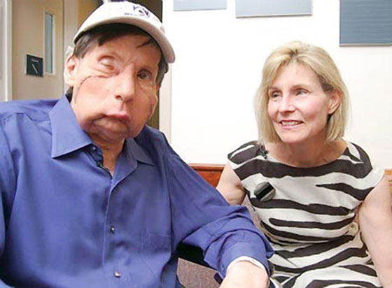 اليك وجها لوجه.. زوجة تتبرع بوجه زوجها لرجل آخر! 