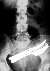 اليكم أغرب صور الأشعة السينية!!