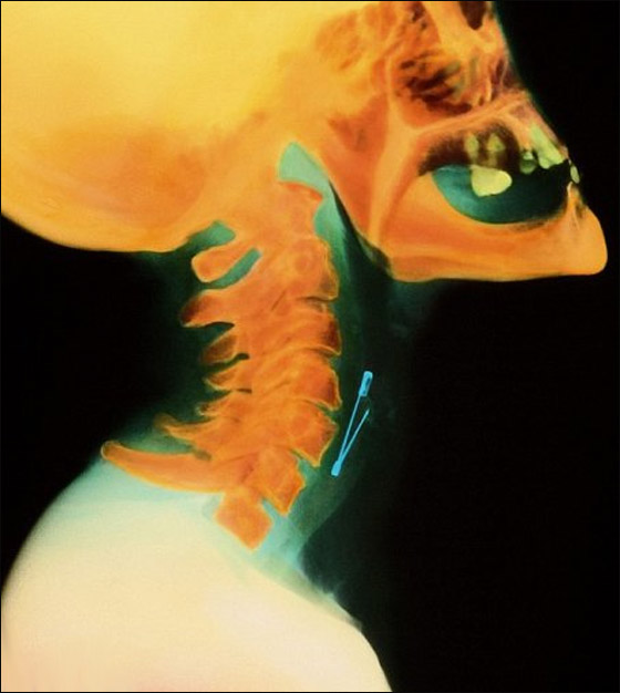 اليكم أغرب صور الأشعة السينية!!