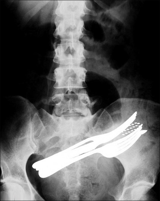 اليكم أغرب صور الأشعة السينية!!