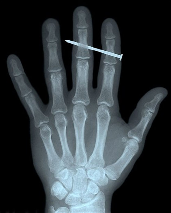 اليكم أغرب صور الأشعة السينية!!