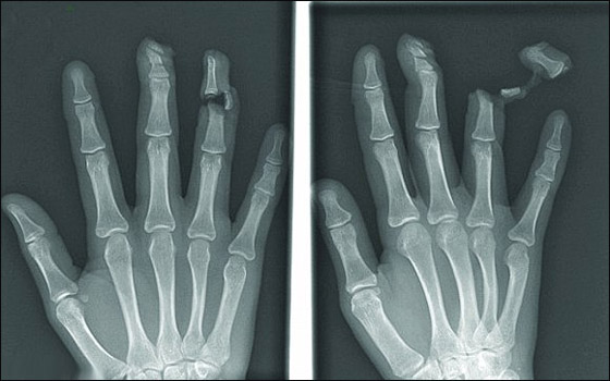 اليكم أغرب صور الأشعة السينية!!