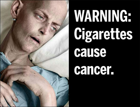 صور تحذيرية ترافق العبارات على علب السجائر لمكافحة التدخين!