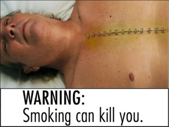صور تحذيرية ترافق العبارات على علب السجائر لمكافحة التدخين!