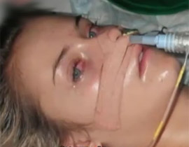 معجزة: مراهقة تستعيد صحتها بعد اصابتها بالشلل اثر تثقيب اذنها! 