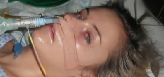 معجزة: مراهقة تستعيد صحتها بعد اصابتها بالشلل اثر تثقيب اذنها! 