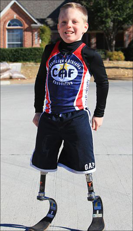 طفل مبتور الساقين يتحدى اعاقته ويحصد عشرات الميداليات!