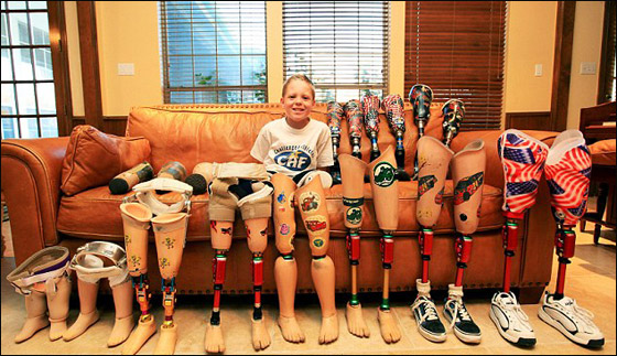 طفل مبتور الساقين يتحدى اعاقته ويحصد عشرات الميداليات!