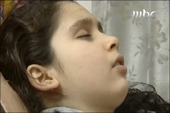 الاميرة الفلسطينية النائمة في سبات عميق.. تحير الاطباء!!