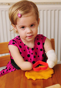 مؤثر.. طفلة مبتورة الاطراف تبدع بالرسم وتبهر والديها!!