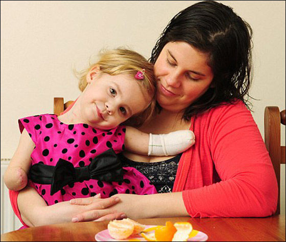 مؤثر.. طفلة مبتورة الاطراف تبدع بالرسم وتبهر والديها!! مؤثر.. طفلة مبتورة الاطراف تبدع بالرسم وتبهر والديها!!