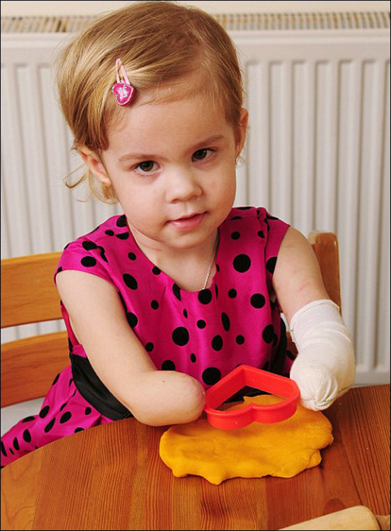 مؤثر.. طفلة مبتورة الاطراف تبدع بالرسم وتبهر والديها!! مؤثر.. طفلة مبتورة الاطراف تبدع بالرسم وتبهر والديها!!