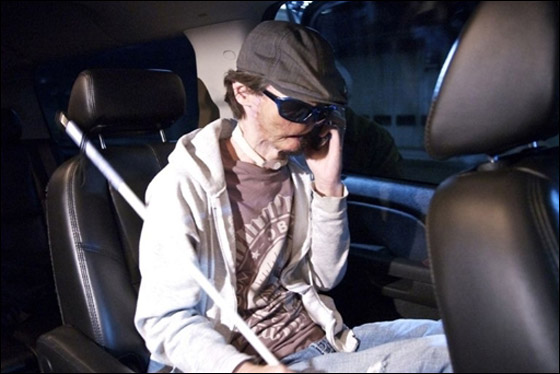 لأول مرة في الطب الامريكي: عملية نقل كامل للوجه تتم بنجاح!! لأول مرة في الطب الامريكي: عملية نقل كامل للوجه تتم بنجاح!!