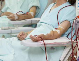 كاليفورنيا: تبادل الكلى بخمس طرق فريدة!!