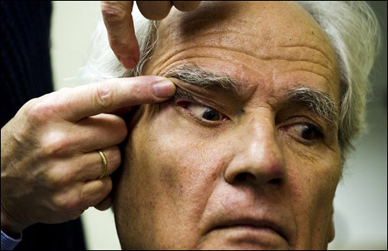 بصيص امل للمكفوفين.. عين اصطناعية بـ100 الف دولار! بصيص امل للمكفوفين.. عين اصطناعية بـ100 الف دولار!