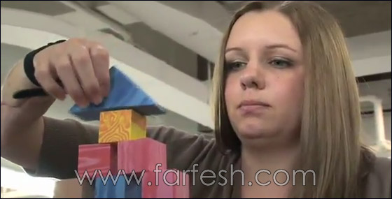 بالفيديو.. اول عملية ناجحة لزراعة اليد في الولايات المتحدة! 