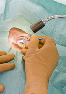 بعد 15 عاما من العمى.. كفيف تسعيني يستعيد بصره!!