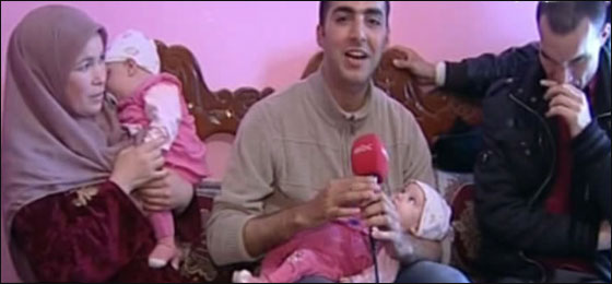 نجاح فصل توامين سياميين بعد امر خادم الحرمين بالتكفل بهما 