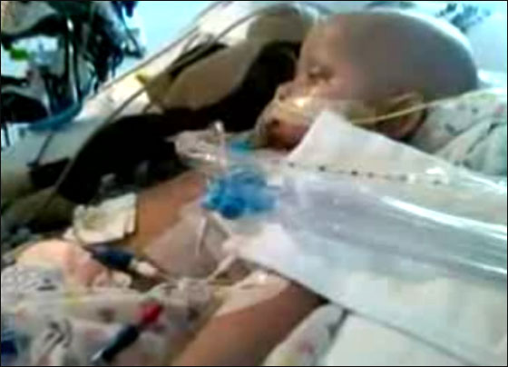 الوالد قدم لطفله الماريجوانا سرا.. فشفي من سرطان الدماغ! 