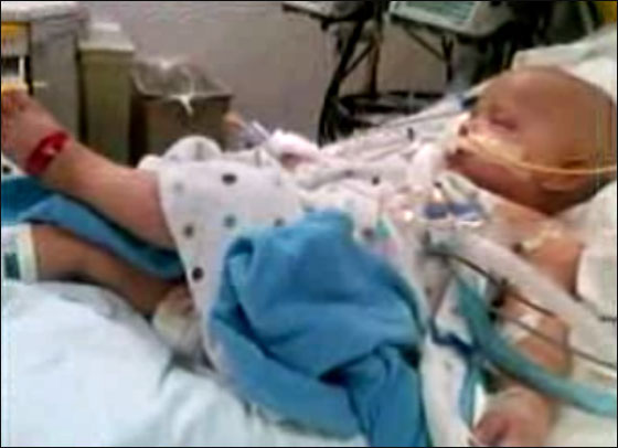 الوالد قدم لطفله الماريجوانا سرا.. فشفي من سرطان الدماغ! 