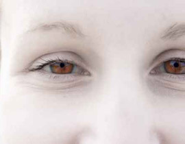 الفتيات المهق.. افضل علاج للايدز في تنزانيا!!