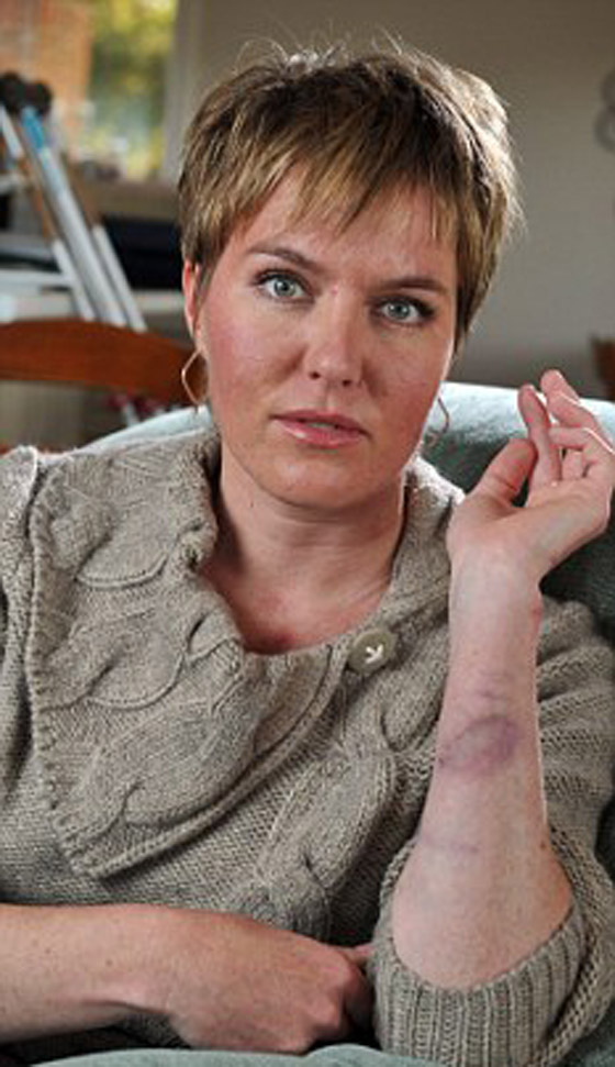 "دم البقرة" ينقذ حياة امرأة فقدت 4 ليترات من الدم!!