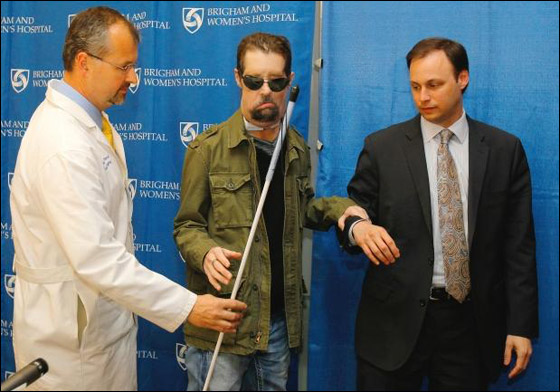 بعد خضوعة لاول عملية نقل وجه.. المريض يستعيد حاسة الشم!!