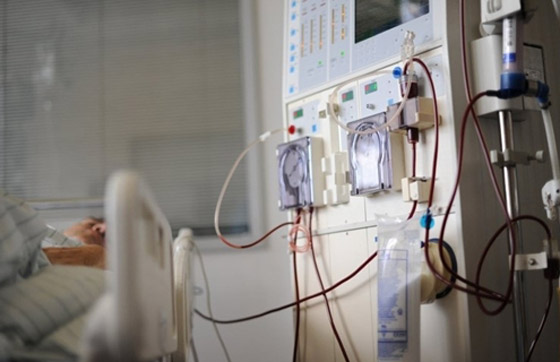 بكتيريا من نوع E.coli تنتشر بشكل خطير وتسبب وفيات