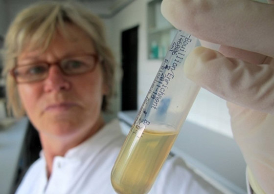 بكتيريا من نوع E.coli تنتشر بشكل خطير وتسبب وفيات