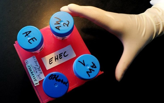 بكتيريا من نوع E.coli تنتشر بشكل خطير وتسبب وفيات