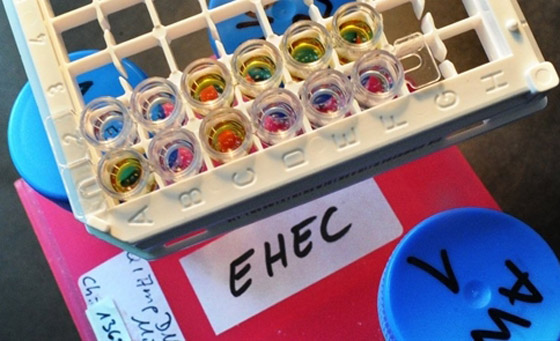 بكتيريا من نوع E.coli تنتشر بشكل خطير وتسبب وفيات