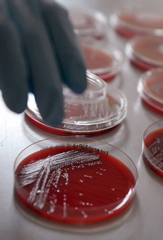 بكتيريا من نوع E.coli تنتشر بشكل خطير وتسبب وفيات