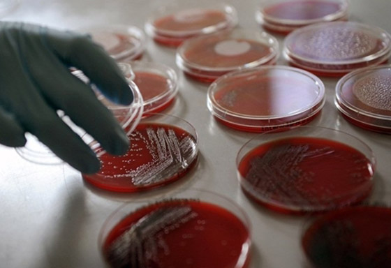 بكتيريا من نوع E.coli تنتشر بشكل خطير وتسبب وفيات