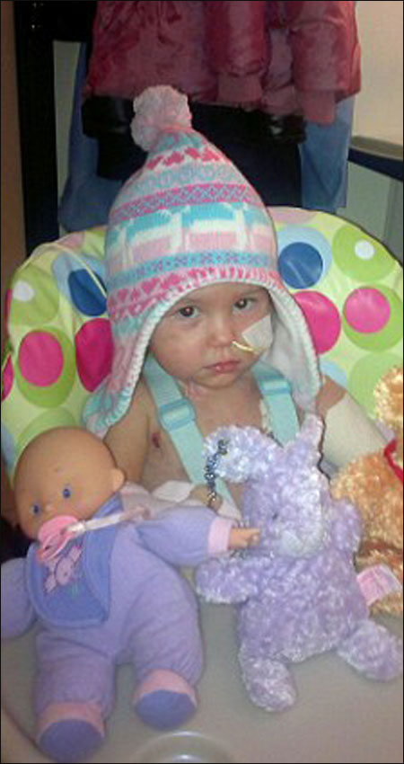 طفلة مبتورة الاطراف ترتدي حذائها المفضل مجددا بفضل ساقي الاميرة