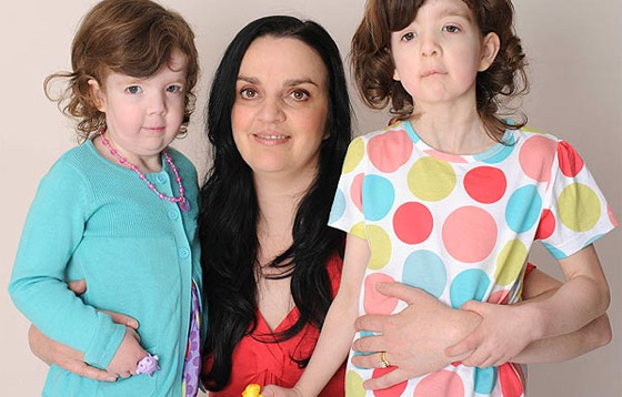 مرض الشيخوخة المبكر يصيب طفلتان وهما في أول العمر!