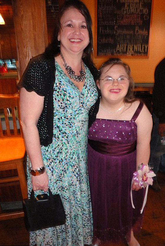 شابة تعاني من أعراض متلازمة داون تتوج ملكة حفلة راقصة