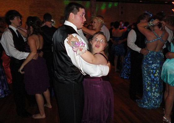 شابة تعاني من أعراض متلازمة داون تتوج ملكة حفلة راقصة