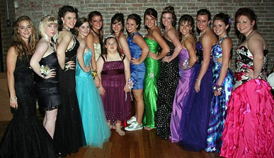 شابة تعاني من أعراض متلازمة داون تتوج ملكة حفلة راقصة