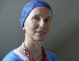 محيّر: كان شعرها اجمل ما فيها.. وبين ليلة وضحاها اختفى كله!