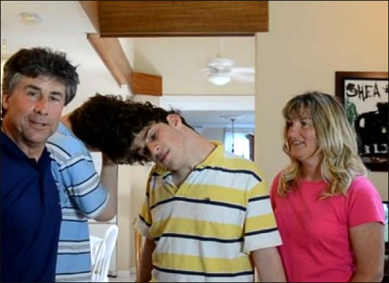 لاول مرة: توامان سياميان لا يريان بعضهما يرويان قصتهما 